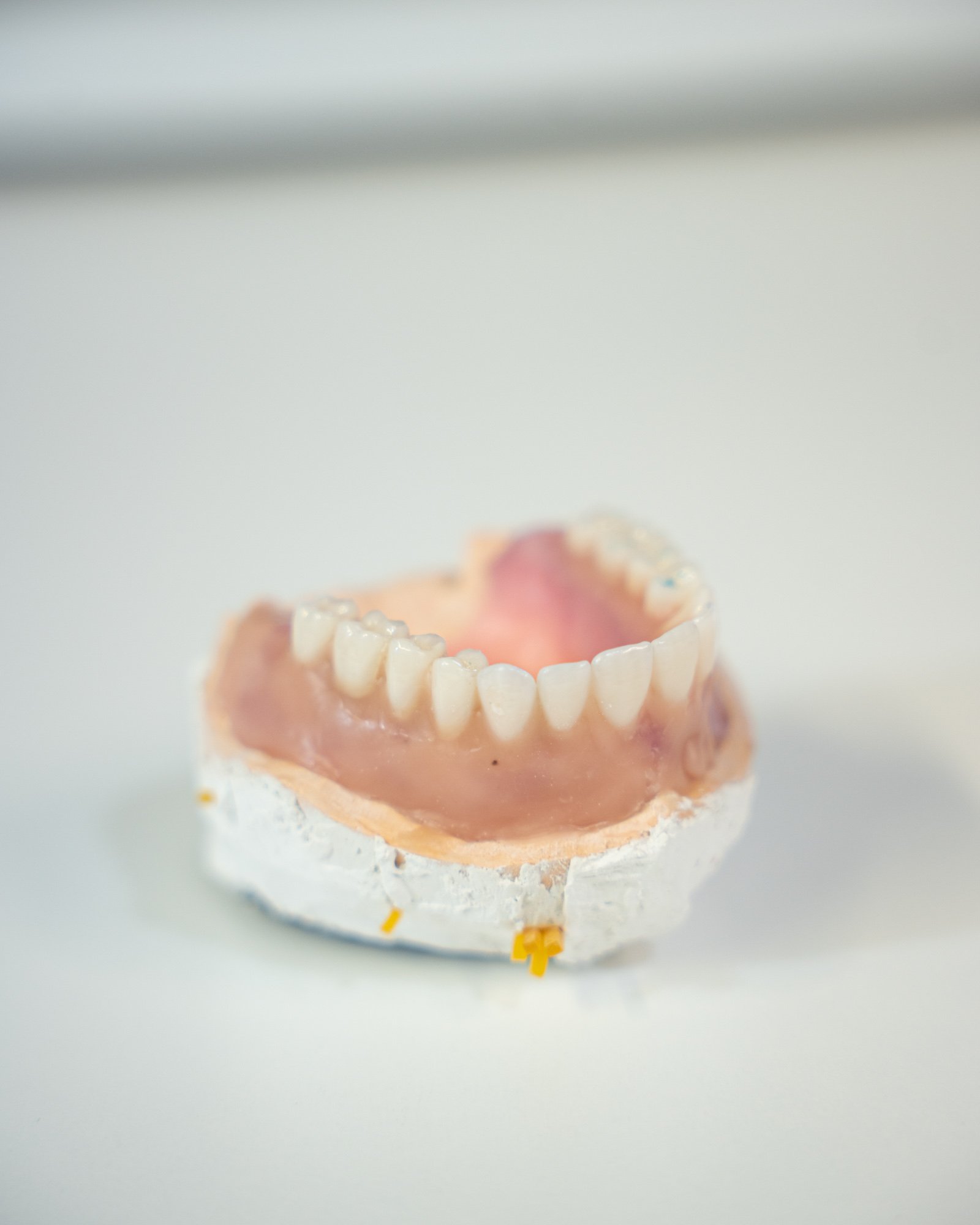 Prótesis removibles en 24h: soluciones rápidas con calidad garantizada